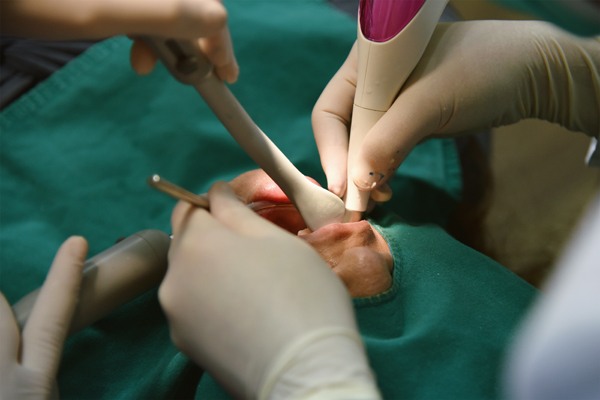 Common Oral Surgery Procedures
